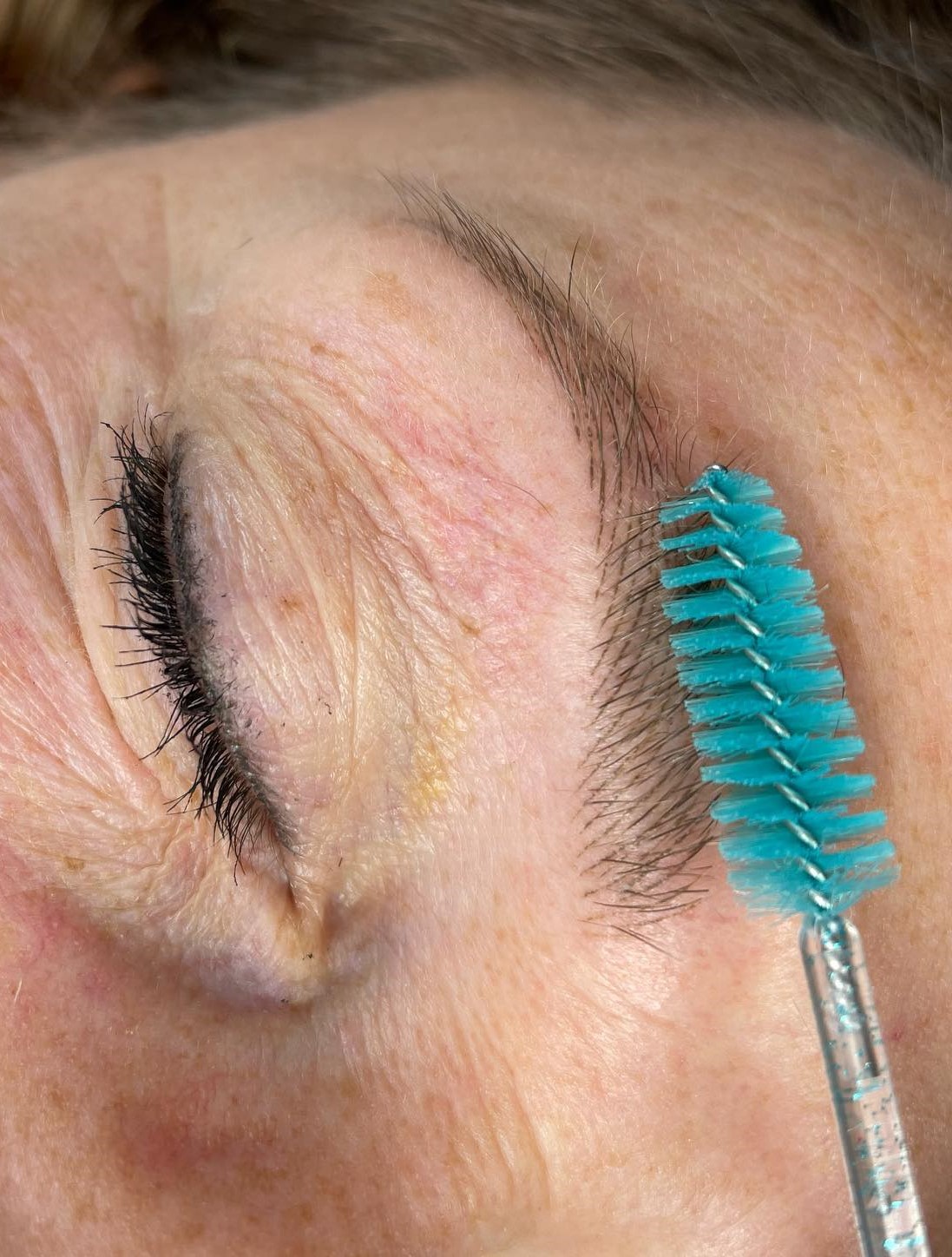 Healed brow pigmentation close-up