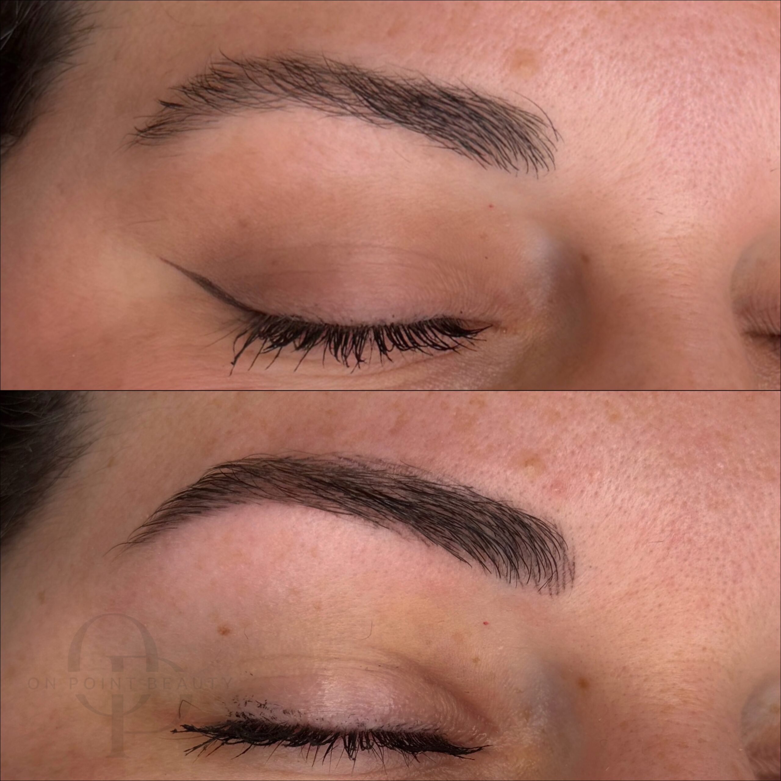 Healed pigmentation result