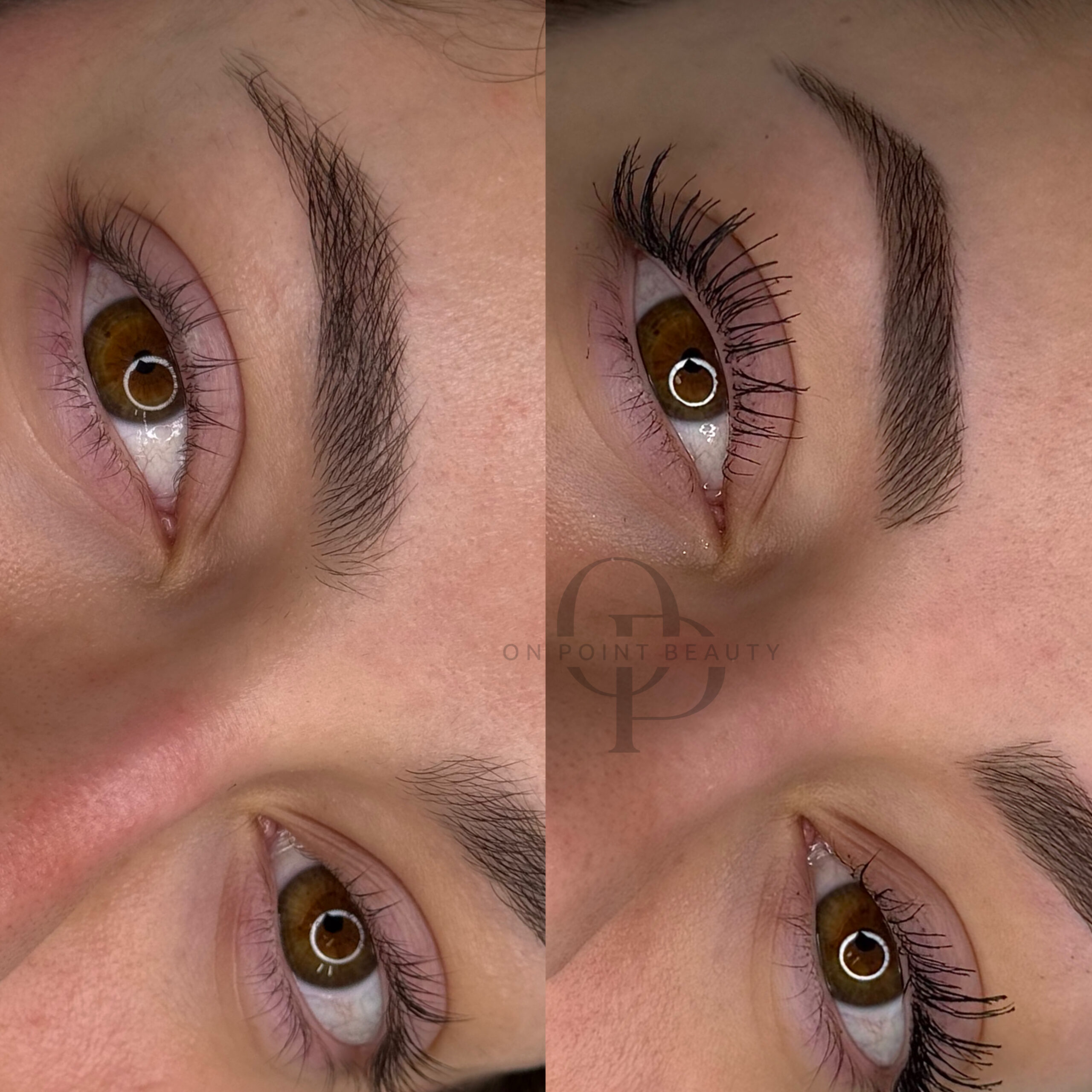 Healed brow shape result