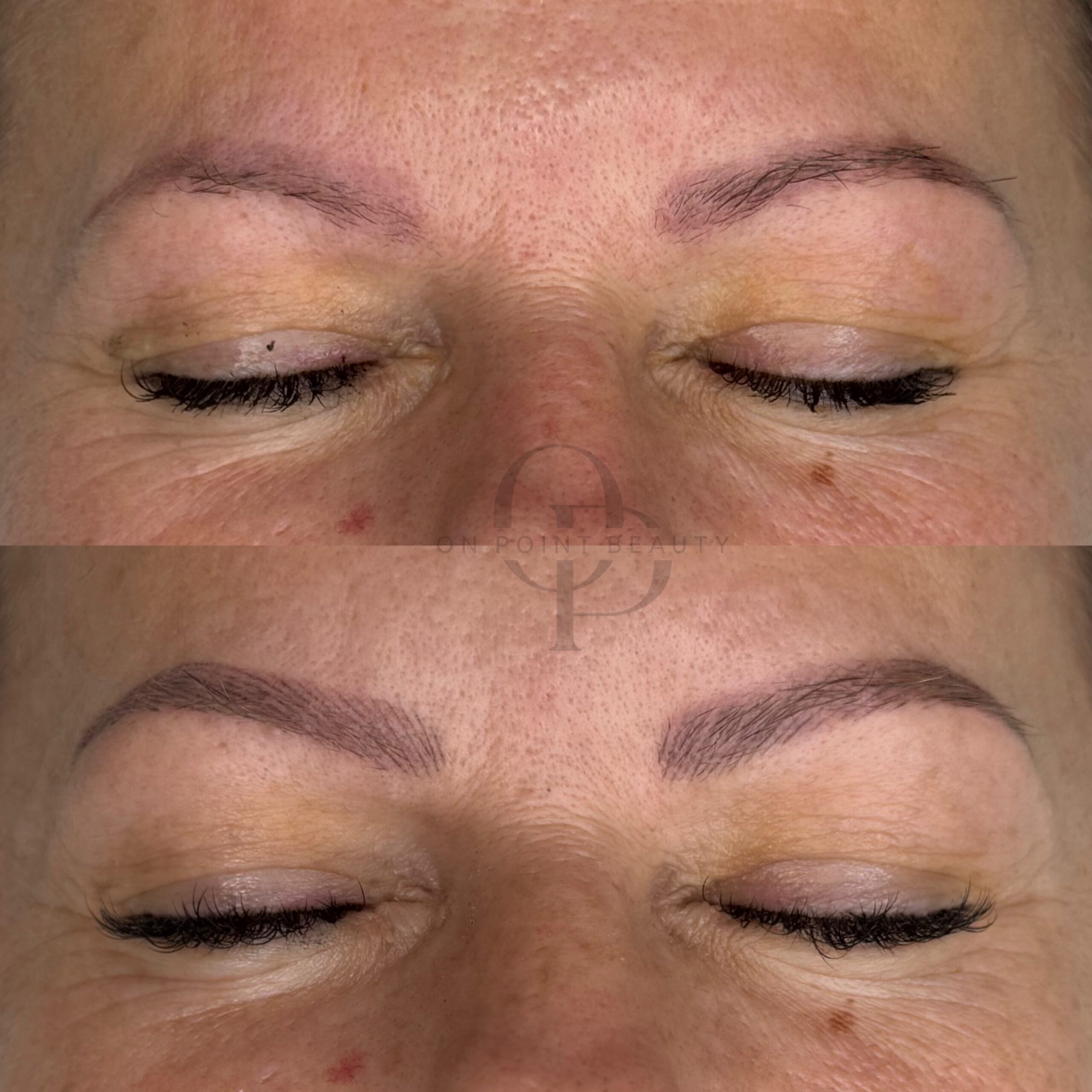Healed brow pigmentation result