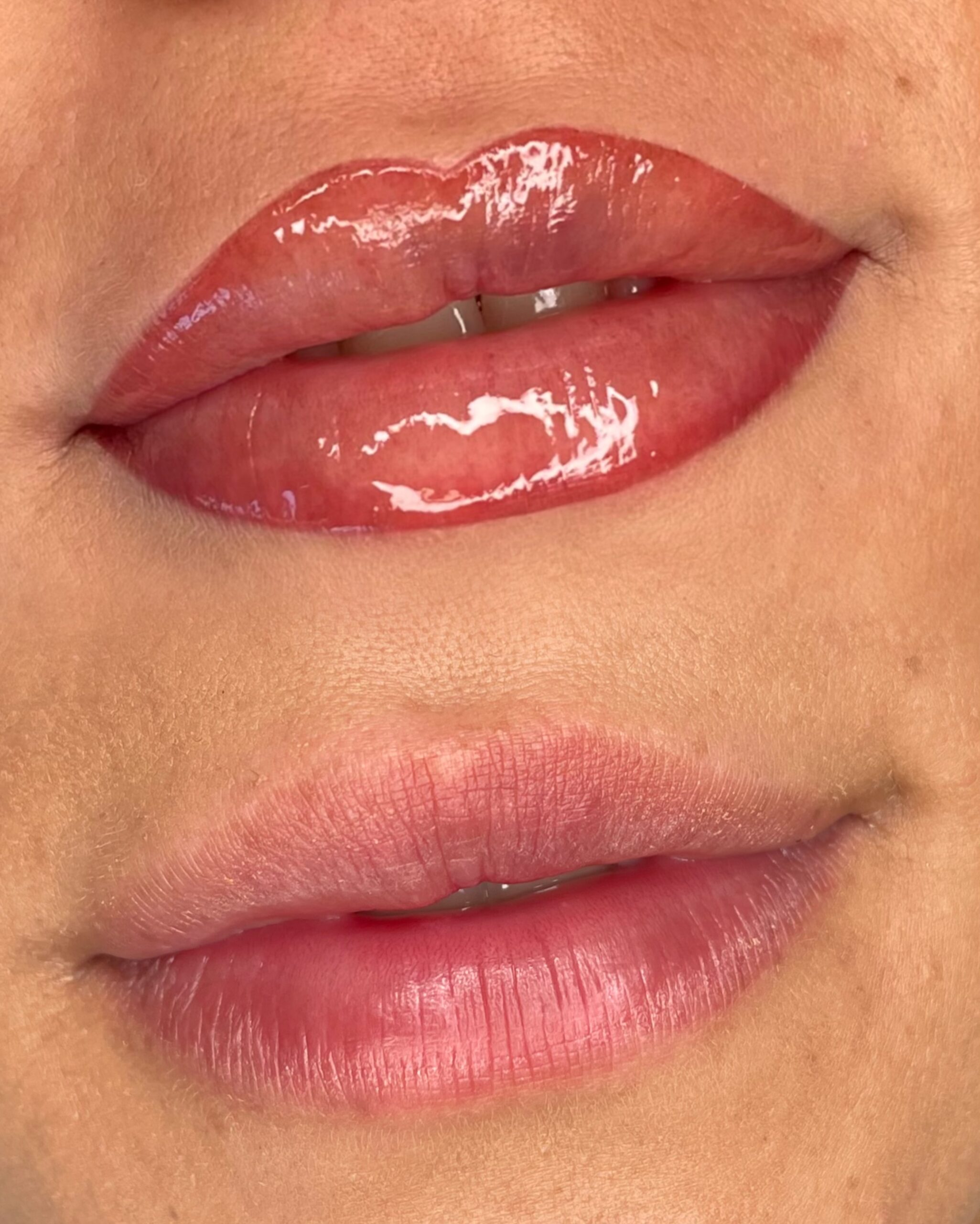 Ombre Lips healed result